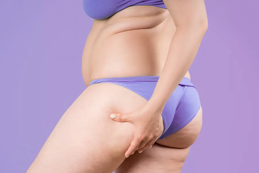 Body Lift