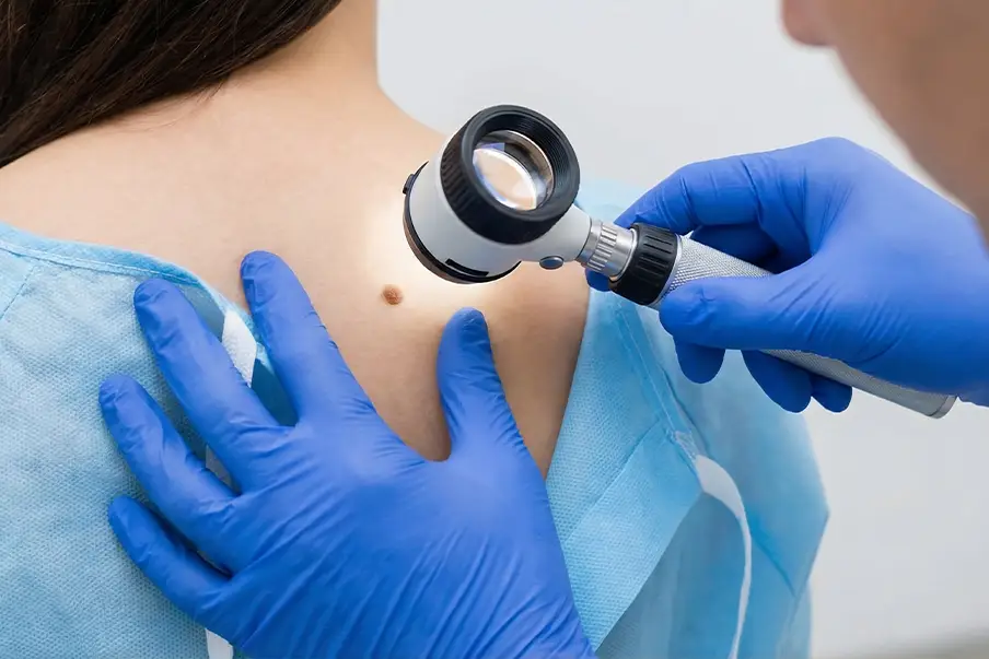 Skin Cancer Surgery
